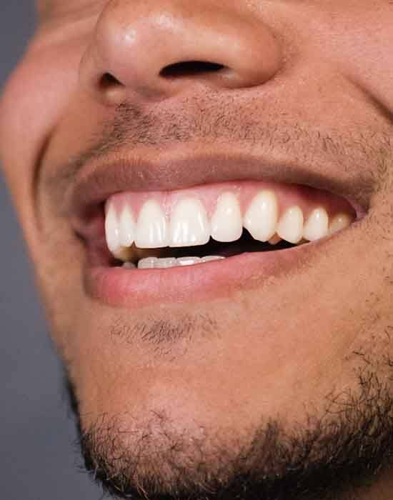 Closeup of a man smiling