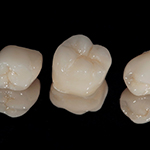 a closeup of dental crowns