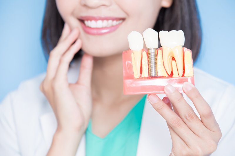 A woman dentist holding up an enlarged dental implant model